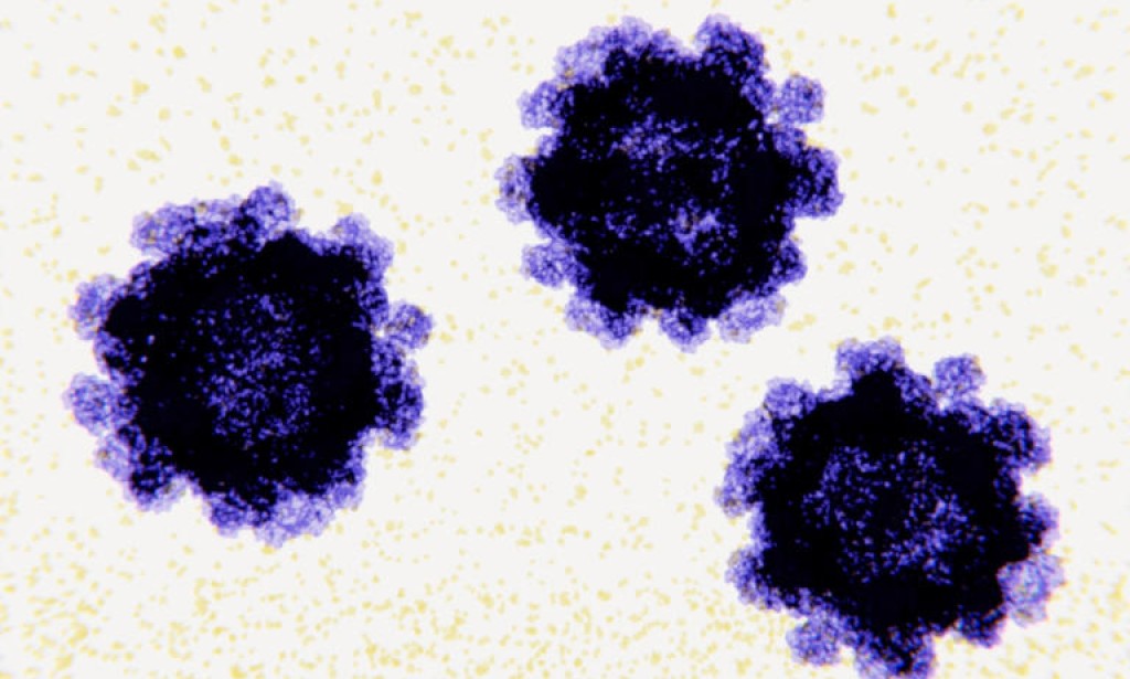 Cases of norovirus on the rise with double the rate of positive tests since August