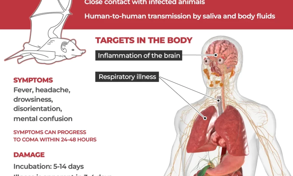 Why is India’s Nipah virus outbreak spooking the world?